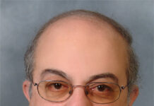 Ο Έρχιουρμαν και η λύση του Κυπριακού