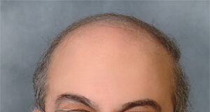 Και ο νικητής είναι ο “ειρηνοποιός” Ντόναλντ Τραμπ !!!