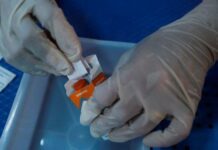 Περισσότεροι από 80.000 άνθρωποι στην Κύπρο ζουν με κάποια μορφή Χρόνιας Νεφρικής Νόσου