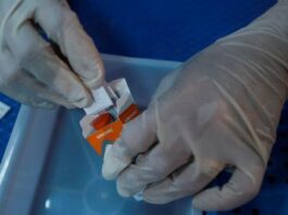 Περισσότεροι από 80.000 άνθρωποι στην Κύπρο ζουν με κάποια μορφή Χρόνιας Νεφρικής Νόσου
